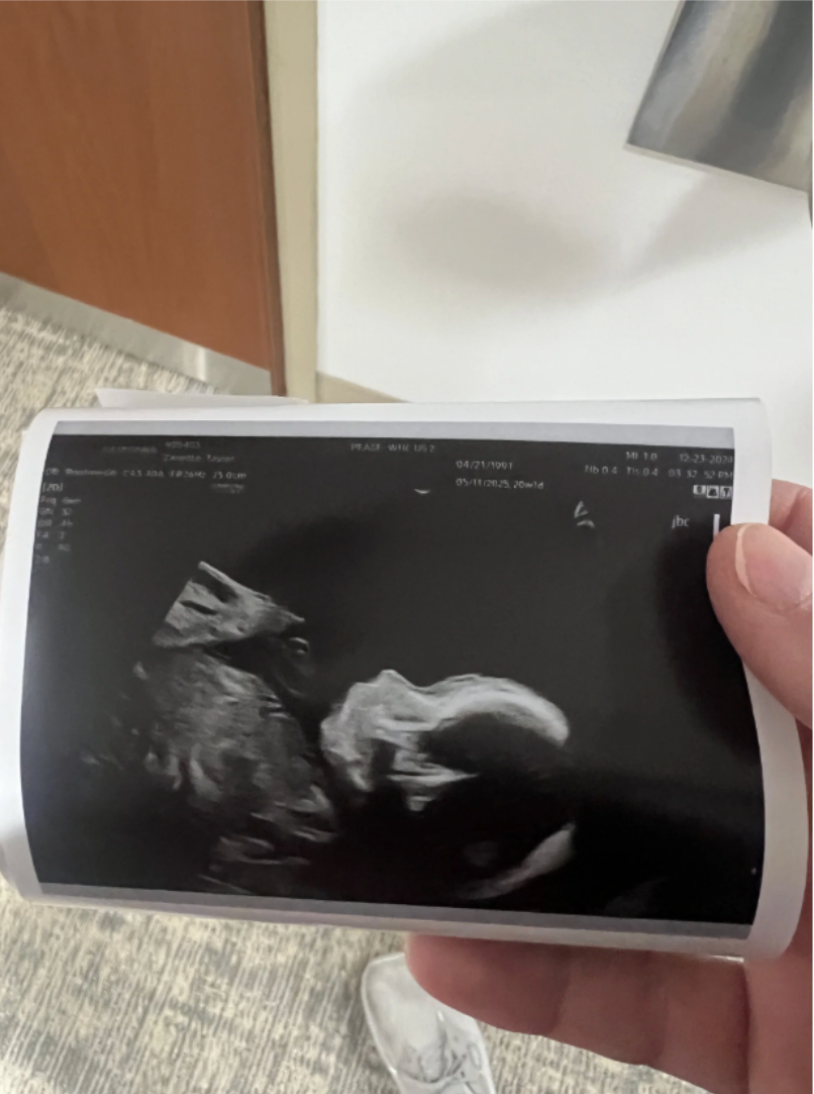 a hand holding an ultrasound baby picture